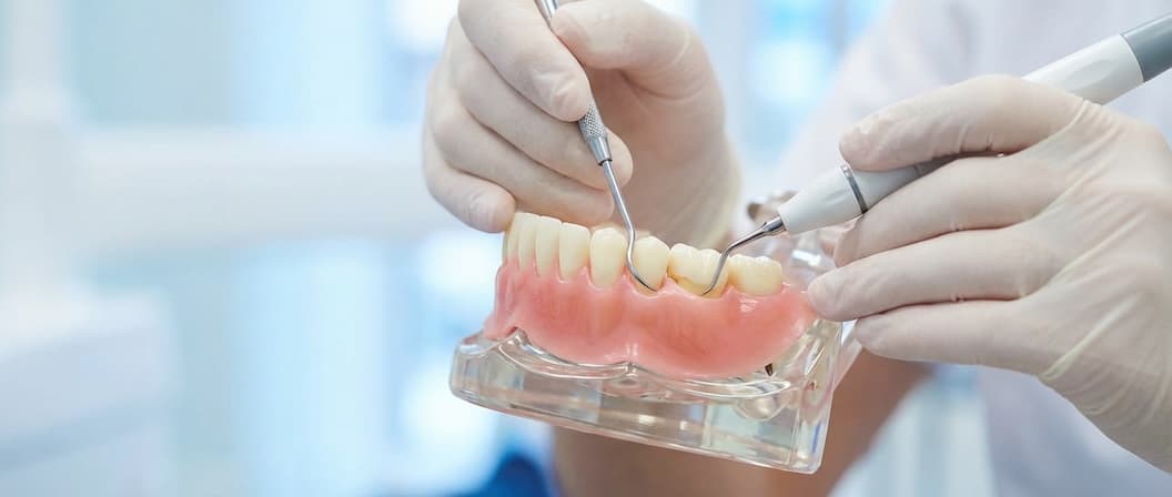 Deep Cleaning (Scaling & Root Planing) - Dental service at Prime Dental